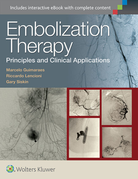 Embolization Therapy: Principles and Clinical Applications 2015