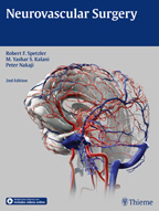 Neurovascular Surgery 2/E 2015