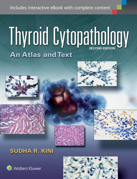 Thyroid Cytopathology: An Atlas and Text  Second Edition 2015
