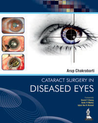 Cataract Surgery in Diseased Eyes (已絕版)