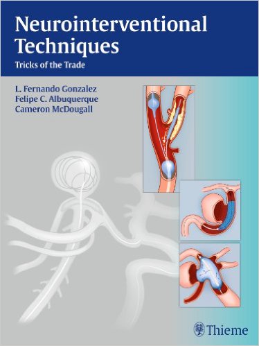 Neurointerventional Techniques: Tricks of the Trade