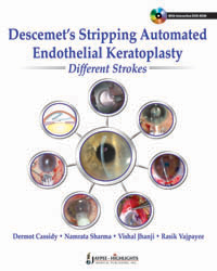Descemet’s Stripping Automated Endothelial Keratoplasty: Different Strokes