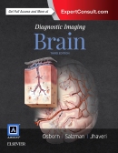 Diagnostic Imaging: Brain, 3rd Edition 2016