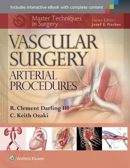 Master Techniques in Surgery: Vascular Surgery: Arterial Procedures 2016