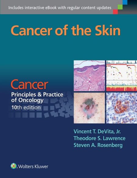 Cancer of the Skin 2016
