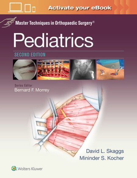 Master Techniques in Orthopaedic Surgery: Pediatrics 2/E 2016