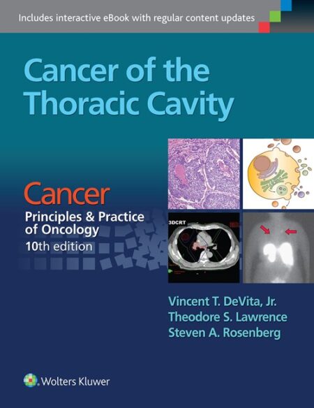 Cancer of the Thoracic Cavity 2016