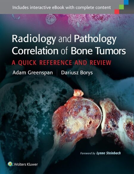 Radiology and Pathology Correlation of Bone Tumors: A Quick Reference and Review 2016