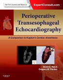 Perioperative Transesophageal Echocardiography: A Companion to Kaplan's Cardiac Anesthesia 2014
