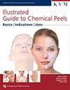 Illustrated Guide to Chemical Peels: Basics, Indications