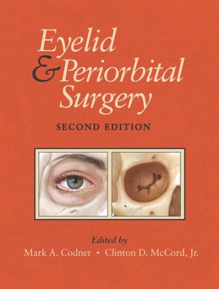 Eyelid and Periorbital Surgery 2Vols, Second Edition 2016