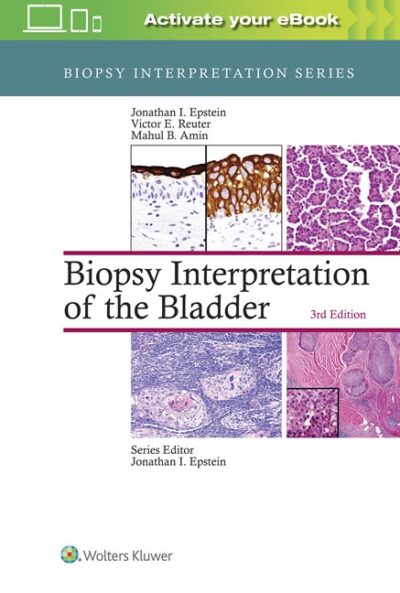 Biopsy Interpretation of the Bladder Third Edition 2017