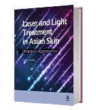 Laser and Light Treatment