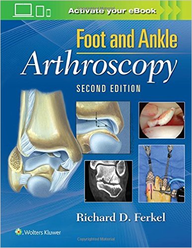 Foot & Ankle Arthroscopy Second Edition