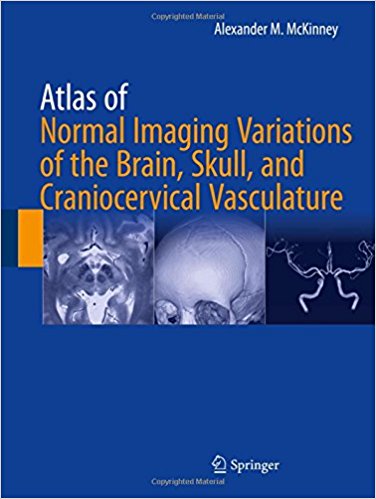 Atlas of Normal Imaging Variations of the Brain, Skull, and Craniocervical Vasculature