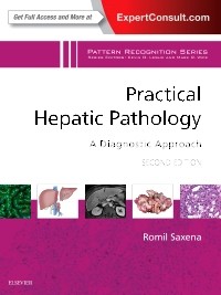 Practical Hepatic Pathology: A Diagnostic Approach: A Volume in the Pattern Recognition Series, 2nd Edition 2018