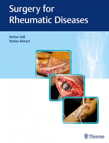 Surgery for Rheumatic Diseases 2017