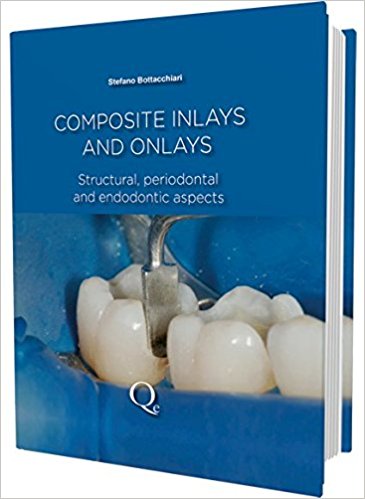 Composite Inlays and Onlays: Structural, Periodontal, and Endodontic Aspects