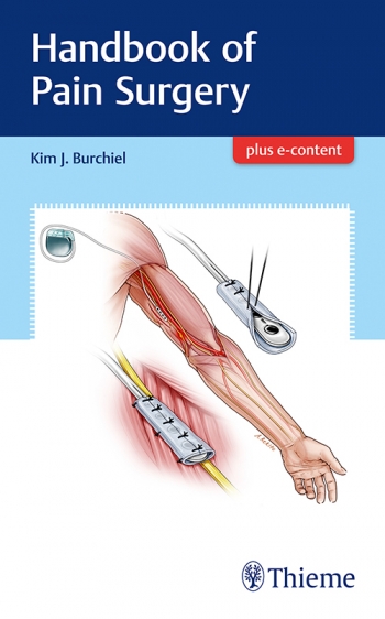 Handbook of Pain Surgery 2018