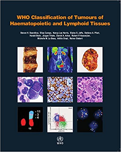 WHO Classification of Tumours of Haematopoietic and Lymphoid Tissues  Revised Edition 2017