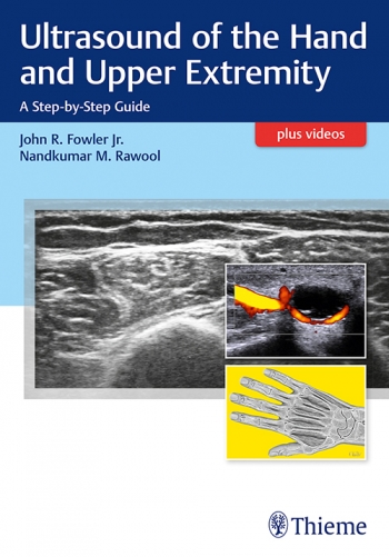 Ultrasound of the Hand and Upper Extremity: A Step-by-Step Guide 2018