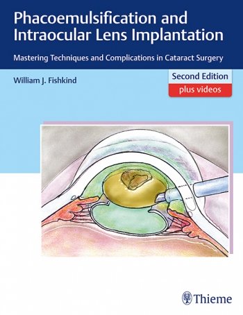 Phacoemulsification and Intraocular Lens Implantation: Mastering Techniques and Complications in Cataract Surgery 2nd Ed