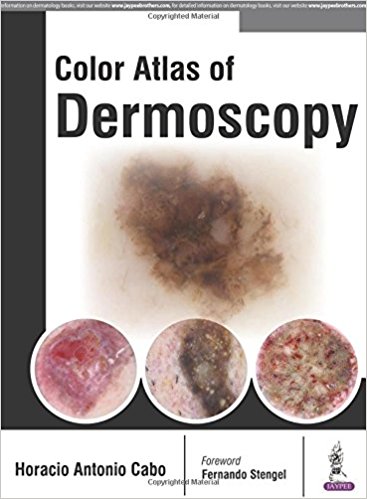 Colour Atlas of Dermoscopy 2017