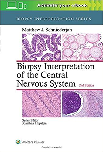 Biopsy Interpretation of the Central Nervous System 2/E 2018