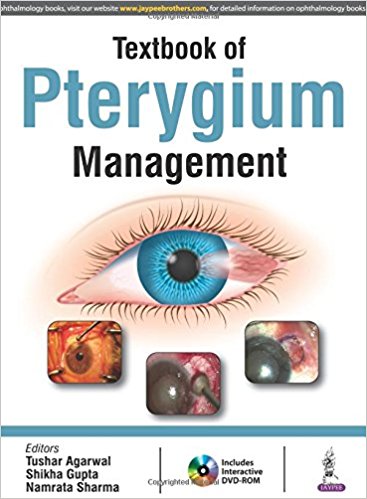 Textbook of Pterygium Management +CD