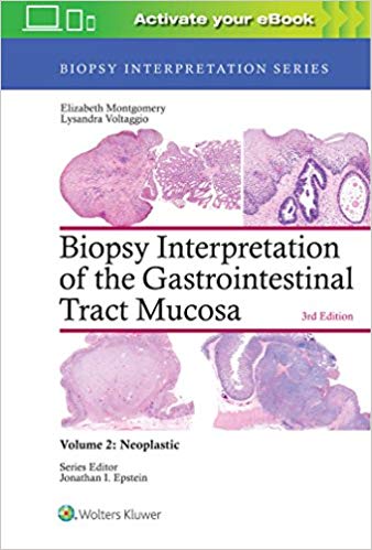 Biopsy Interpretation of the Gastrointestinal Tract Mucosa: Volume 2: Neoplastic 3/E