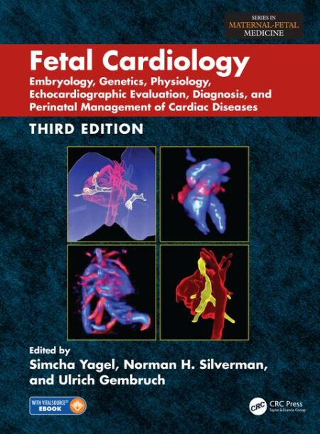 Fetal Cardiology: Embryology, Genetics, Physiology, Echocardiographic Evaluation, Diagnosis, and Perinatal Management of
