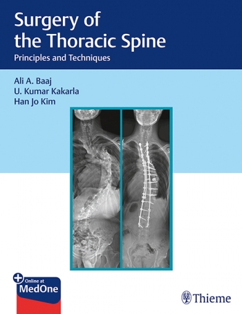 Surgery of the Thoracic Spine: Principles and Techniques 2019