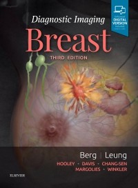 Diagnostic Imaging: Breast 3rd Edition 2020