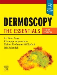 Dermoscopy: The Essentials 3/E 2020