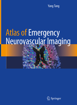 Atlas of Emergency Neurovascular Imaging 2020