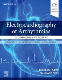 Electrocardiography of Arrhythmias: A Comprehensive Review: A Companion to Cardiac Electrophysiology 2/E 2022