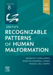 Smith's Recognizable Patterns of Human Malformation 8/E 2022