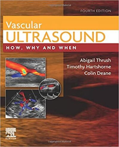 Vascular Ultrasound: How, Why and When 4/E 2023