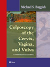 Colposcopy of the Cervix, Vagina, and Vulva - A Comprehensive Textbook