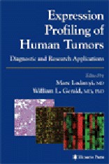 Expression Profiling of Human Tumors