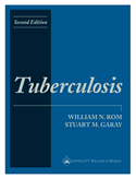 Tuberculosis: Hardbound