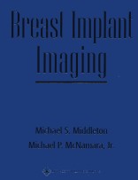 Breast Implant Imaging , Hardbound Text Plus CD-ROM