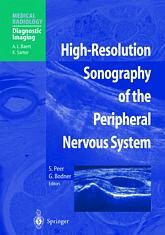High-Resolution Sonography of the Peripheral Nervous System