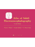 Atlas of Adult Electroencephalography