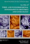 An Atlas of 3 and 4 Dimensional Sonography in Obstetrics and Gynecology