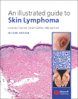 An Illustrated Guide to Skin Lymphoma