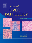 Atlas of Liver Pathology, 2nd Edition