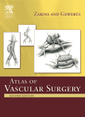 Atlas Of Vascular Surgery, 2nd Edition