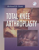 Total Knee Arthroplasty + DVD 2006