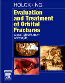 Evaluation and Treatment of Orbital Fractures - A Multidisciplinary Approach 2/E